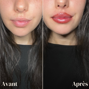 Lip Stain Peel Off