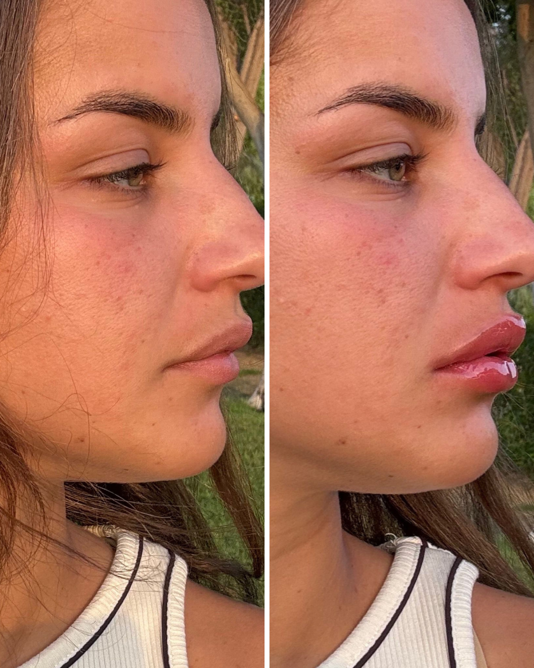 Lip Volume Extrême