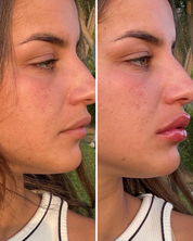 Lip Volume Extrême