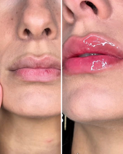 Lip Volume + Lip Stain