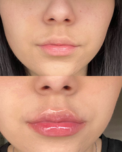 Lip Volume Extrême