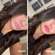 Lip Volume Extrême