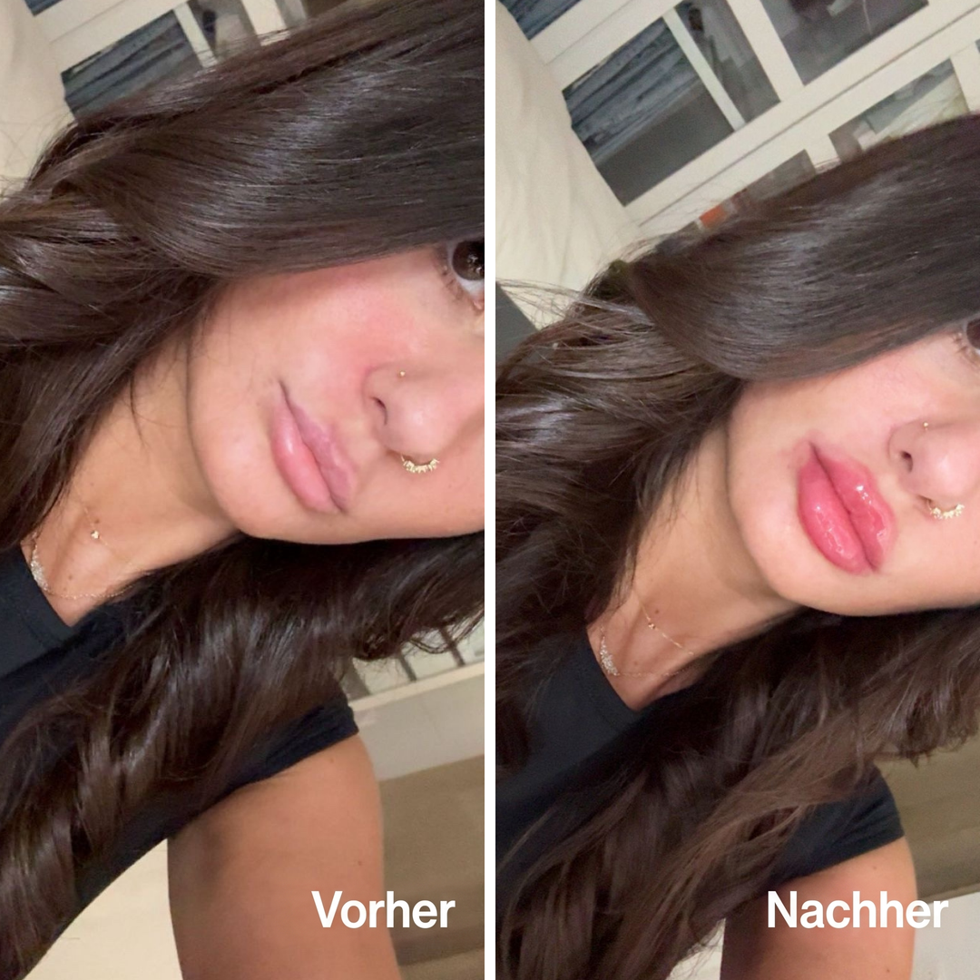 Lip Volume Extrême
