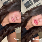 Lip Volume Extrême