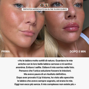 Lip Volume Extrême