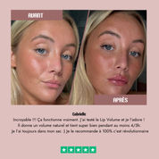 Lip Volume 🌶️ Extreme